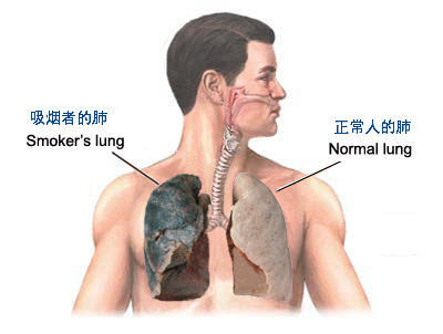 open-uri20130119-565-gixssp